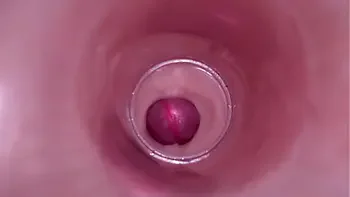 Female Insemination - Internal Camera Captures Deep Male Ejaculation