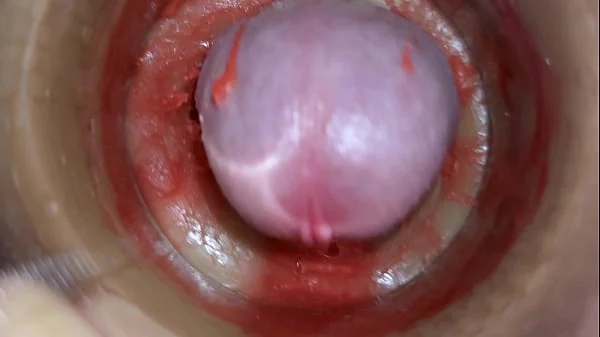 Camera Inside Deep Pussy Captures Huge Ejaculation of Sperm 4k