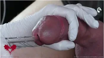 Perfect Extraction Of Sperm Directly From The Urethra. Close-up Of The Glass Straw Sounding