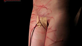 The Cost Of Submission