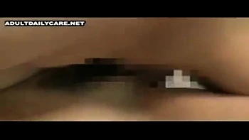 083-youth-with-areare-abs