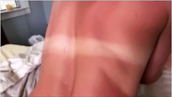 Little Stepsisters Sun Burn Accident - Alex Adams And Arabella Rose